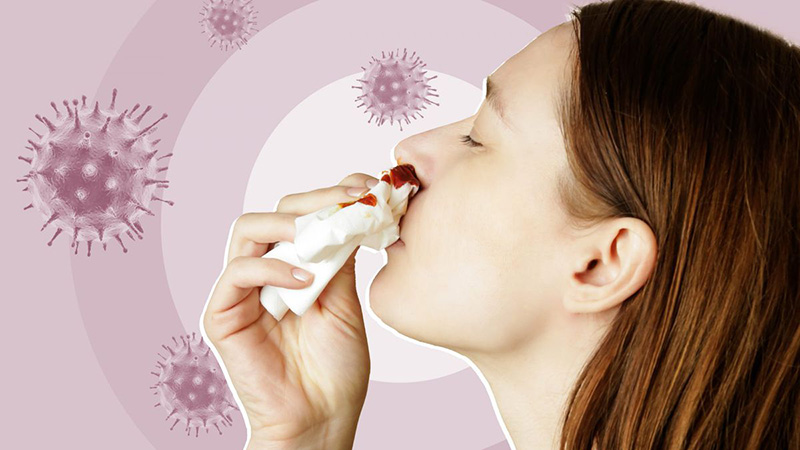 新冠病毒感染流鼻血是怎么回事