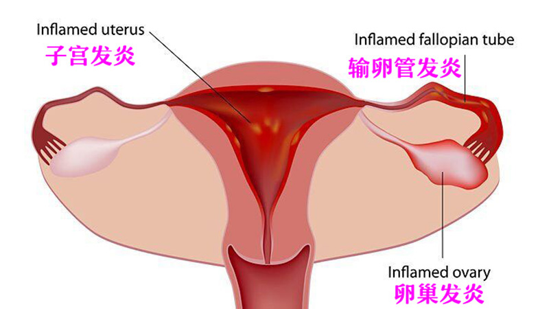 来例假特别疼有什么缓解的方法吗吃什么药管用好